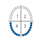 Щипцы для удаления нижних зубов 140-45S Schwert
